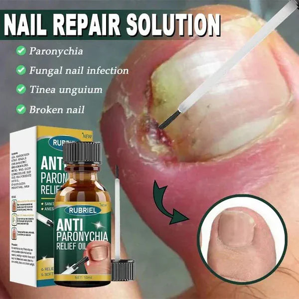 💅MD Anti-Paronychia Nail Relief Oil 🔥 Buy 1 Get 1 FREE  🔥
