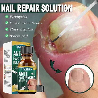 💅MD Anti-Paronychia Nail Relief Oil 🔥 Buy 1 Get 1 FREE  🔥